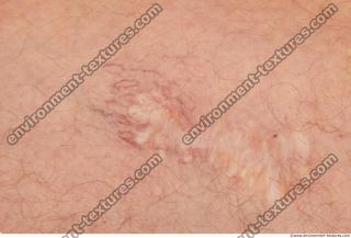 human skin hairy 0009